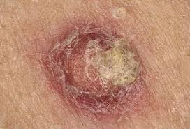 Pin On Medical News