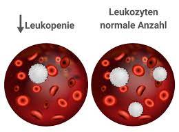 Leukopenie Zu Wenig Weisse Blutkorperchen Leukozyten Praktischarzt