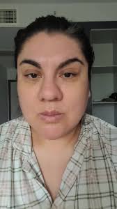 I'm booked in for surgery in October I take alot of vitamin supplements can  you keep taking them after surgery ? Do u take whole with water or does  anyone crush them