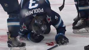 After going undrafted in the nhl entry draft. Tucker Poolman Blocks A Wrist Shot With His Face Vs Flames Sportsnet Ca
