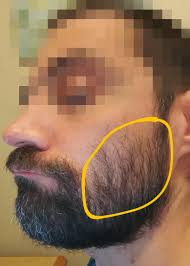 So i have facial hair quite high on my cheek. Do My Cheeks Look Thin For 5 5 Weeks So Far I M Very Happy With My Thick Beard Growth Under My Jaw My Chin Moustache But My Cheeks Seem Underwhelming Beards
