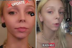 Owner's Warning After Dog 'Very Lucky' to Survive Venomous Rattlesnake Bite 