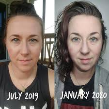 🤢 I'm so sorry for the gross pictures but I wanted to show you how  incredible our skin care line is. On the left you will see what my skin  normally looks