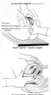 Il est possible que cette douleur. Developpement Et Sante Grossesse Extra Uterine Geu
