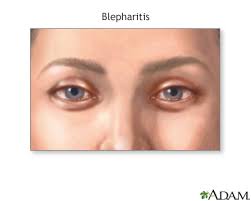 Image result for Blepharis affinis