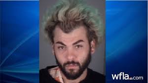 Cops: Trespasser hid machete in removable leg cast