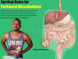 Check spelling or type a new query. Prognosis Survival Rate Of Peritoneal Mesothelioma