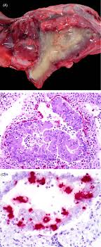 Inclusion Body Disease An Overview Sciencedirect Topics