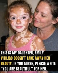 Candy🌸& Brandy💛