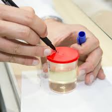 Dikasih air kencing kami juga tidak menuntut kepercayaan kepada semua penonton. Why Urine Tests Are Routine During Pregnancy Babycenter