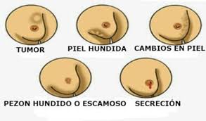 The next section in this guide is statistics. Sobrevivir Al Cancer De Mama Es Posible Prevencion Psicoterapia Queretaro
