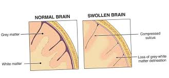 Root Cause Of Memory Loss Yt Registration Simple Smart Science In 2021 Memory Loss Brain Health Neuroscience Memory Problems