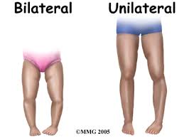 Image result for Pediatric Leg Disorder