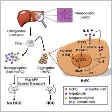 Many forms of malignant cancer may be treated with chemotherapy if caught early. Identification Of Liver Cancer Progenitors Whose Malignant Progression Depends On Autocrine Il 6 Signaling Cell
