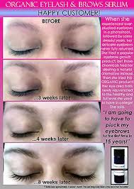 The no.1 serum with highly concentrated compound of super fortifying peptide and direct plumping hyaluronic acid which are suspended in an innovative hydro delivery system to get. 7 Before And After Best Organic Eyelash Growth Serum Safe For Eyebrows Fast Hair Ebay
