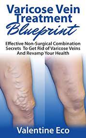 Varicose Vein Treatment Blueprint: Effective Non-Surgical Combination  Secrets To Prevent, Get Rid Of Varicose Veins & Revamp Your Health - Kindle  Edition By Eco, Valentine. Health, Fitness & Dieting Kindle Ebooks @