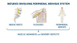 Image result for Neurologic Lesion Localization
