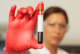 It can strike suddenly, move swiftly through the human body, and change but what if this deadliest of assassins could be detected by a simple blood test? New Blood Test Can Detect Blood Cancer Five Years Earlier Than Symptoms Surface Study Lifestyle News India Tv