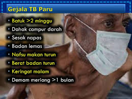 Anda terkena dahak berdarah tanpa batuk ? Alfian Nur Rosyid Md Pulmonologist Ppt Download