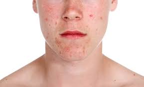 Hence, the causes of the pain can be many. Left Rib Sticks Out More Than Right The Student Room