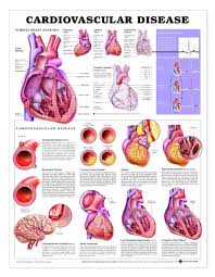 Cardiovascular Disease Laminated Anatomical Chart 3rd Edition