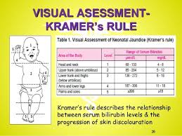 If it's thought your baby has jaundice, the level of bilirubin in their blood will need to be tested. Poliklinik Ukm Kesihatan Bandar Baru Bangi 24 Jam Ujian Jaundis 1 Apakah Itu Jaundis Jaundis Kekuningan Merupakan Satu Perkara Yang Kerap Di Alami Oleh Bayi Yang Baru Lahir Punca Kuning Bayi Yang