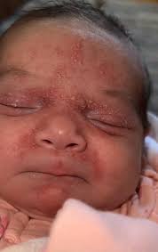 What are these bumps