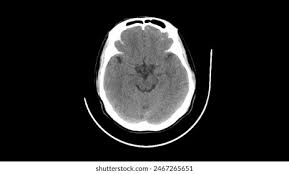 Image result for CT Head
