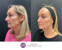 Who is Dr Rekha Tailor?