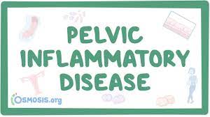 Pelvic Inflammatory Disease Causes Symptoms Diagnosis Treatment Pathology Youtube