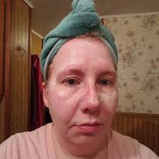 There's nothing like accidentally using the face wash with PEPPERMINT in it 