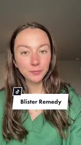 How to Get Rid of Blisters in My inside of Legs