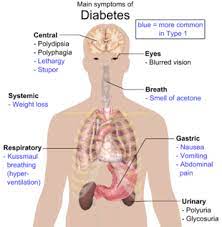 It is a chronic disease of carbohydrate, fat, and protein metabolism caused by the lack of insulin, which results from the marked and progressive inability of the pancreas to secrete insulin. Type 1 Diabetes Wikipedia