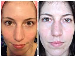 Review Leaders Insolution Mela Tox Skin Clinic Mask Asian Beauty Obsessed