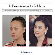 Pin On Facial Contouring