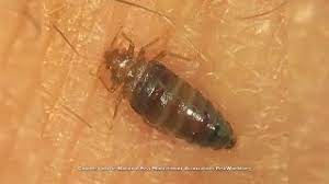We talked to two entomologists and an exterminator to find out what to do if you have bedbugs. Here S Why Bed Bugs Are So Hard To Get Rid Of Youtube
