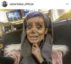 Iranian Gets Plastic Surgery To Look Like Angelina Jolie, It Doesn't Go  Well