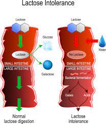 Lactose Intolerance - Islamicity