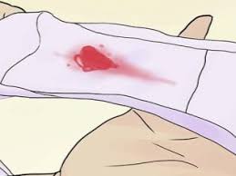 Setelah pembuahan, lendir serviks akan terlihat lebih kental, lembut, dan akan sesak napas bisa jadi tanda awal kehamilan karena tubuh mulai membutuhkan lebih banyak oksigen dan darah. Seleksi Dalam Bentuk Lendir Selama Kehamilan Apa Yang Harus Menjadi Alokasi Lendir Selama Kehamilan Pembentukan Colokan Mukosa