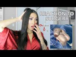 The requirement for gender reassignment surgery is outdated: Reaction To Gender Reassignment Surgery Youtube