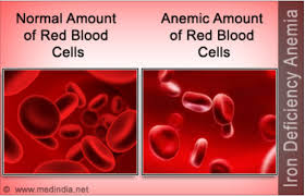 On 16th aug 2015 vitamin d from sunlight. Anaemia My Hair Doctor Prescription Haircare
