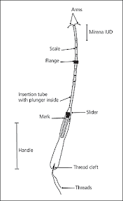The insertion and/or removal of iuds are reported using one of the following cpt codes: Insertion And Removal Of Intrauterine Devices American Family Physician