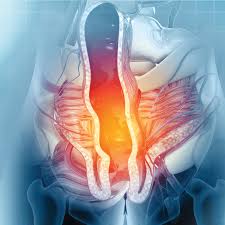 Image result for hemoroid human