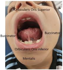 Image result for Periglossum