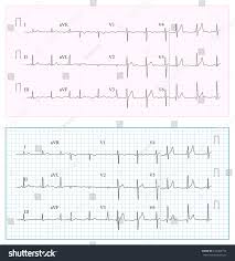 Heart Cardiogram Chart Set Healthy Heart Stock Illustration