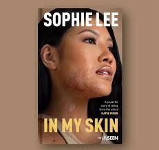 As a mother I must say how proud I am to be able to share this post with  all the lovely people of DARWEN and people who knows of my daughter Sophie