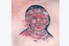 Tattoos 7 Unexpected Skin Reactions And What To Do About Them