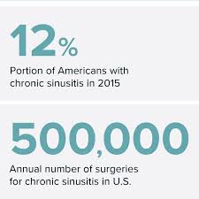 The efficacy is best, if surgery is not done. Snot What You Think The Unknown Toll Of Chronic Sinus Problems