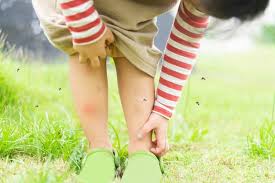 Intepaturi De Insecte Tot Ce Trebuie Sa Stii De La Prevenire La Tratament Si Urgente Medlife