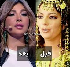 ابنتها السبب| أصالة قبل وبعد عمليات التجميل .. شاهد الفرق